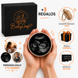 BabyLoop™ | Tu Ecografía y Recuerdos Siempre Contigo
