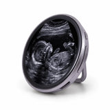 BabyLoop™ | Tu Ecografía y Recuerdos Siempre Contigo