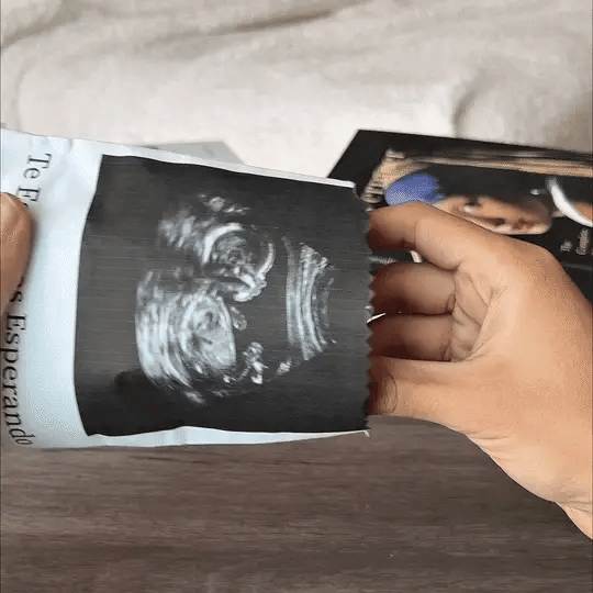 BabyLoop™ | Tu Ecografía y Recuerdos Siempre Contigo